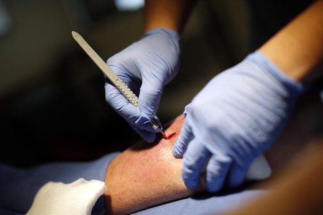 Doctor Andy Chiou debrides a leg wound on patient Larry Kirk in Peoria, Illinois, November 26, 2013. REUTERS/Jim Young Doctor Andy Chiou debrides a leg wound on patient Larry Kirk in Peoria, Illinois, November 26, 2013. REUTERS/Jim Young