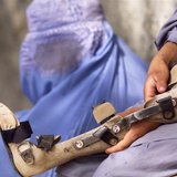 A young boy (R) holds a brace belonging to his sister who was crippled by polio as they wait for the start of her physio-therapy at an ortho A young boy (R) holds a brace belonging to his sister who was crippled by polio as they wait for the start of her physio-therapy at an ortho