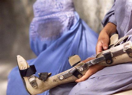 A young boy (R) holds a brace belonging to his sister who was crippled by polio as they wait for the start of her physio-therapy at an ortho A young boy (R) holds a brace belonging to his sister who was crippled by polio as they wait for the start of her physio-therapy at an ortho