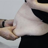A surgeon examines an obese patient in his office as she prepares for surgery at a hospital, in Saint Jean d'Angley, southwestern France, Ja A surgeon examines an obese patient in his office as she prepares for surgery at a hospital, in Saint Jean d'Angley, southwestern France, Ja
