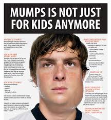 mumps mumps