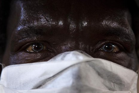 A patient with HIV and tuberculosis (TB) wears a mask while awaiting consultation at the Ubuntu clinic in Cape Town's Khayelitsha township F A patient with HIV and tuberculosis (TB) wears a mask while awaiting consultation at the Ubuntu clinic in Cape Town's Khayelitsha township F