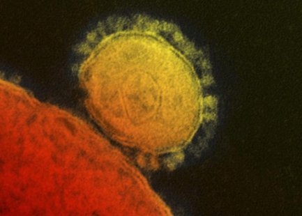 The Middle East respiratory syndrome (MERS) coronavirus is seen in an undated transmission electron micrograph from the National Institute f The Middle East respiratory syndrome (MERS) coronavirus is seen in an undated transmission electron micrograph from the National Institute f
