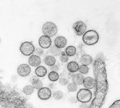 Centers for Disease Control Centers for Disease Control